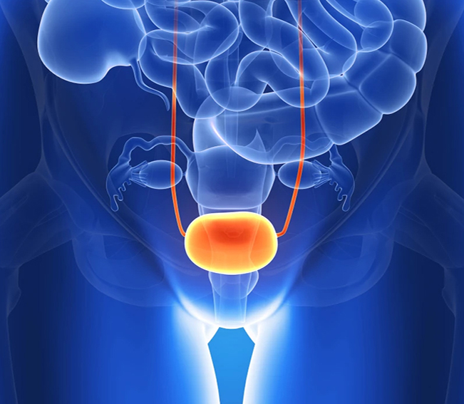 Anti-inflammatory